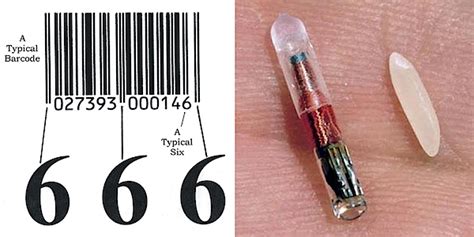 rfid chip mark of the beast forehead|Radio.